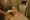 3 legend pro microneedling rf