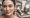 chemical peel aftercare skincarepng