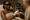 2025 08 myskintasticcom blog laser hair removal for dark skin v1