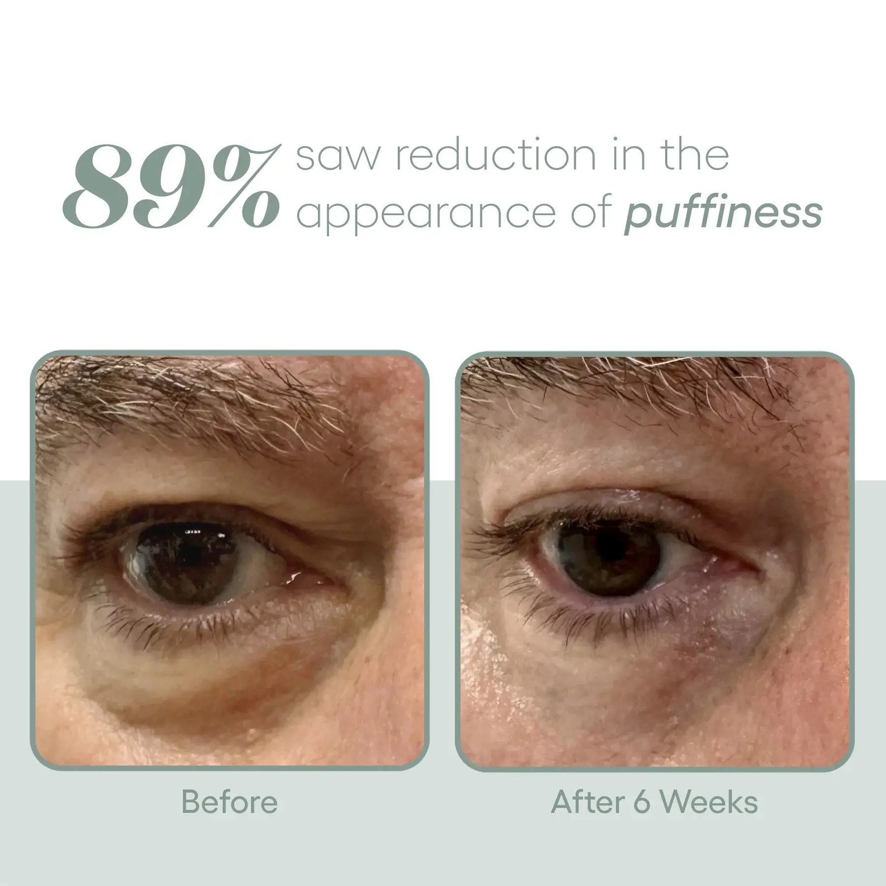 exosome eye serum plated 3 my skintastic - exosome eye serum plated 3