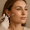 2025 08 myskintasticcom blog cheek fillers without surgery spring hill fl v1