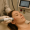 fontona micropeel laser skin treatment