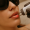 liplase laser lip treatment