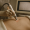 stretch marks removal near me